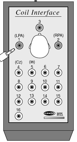 Head Coil Interface Box.