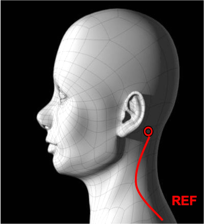 ECG Reference Lead Placement