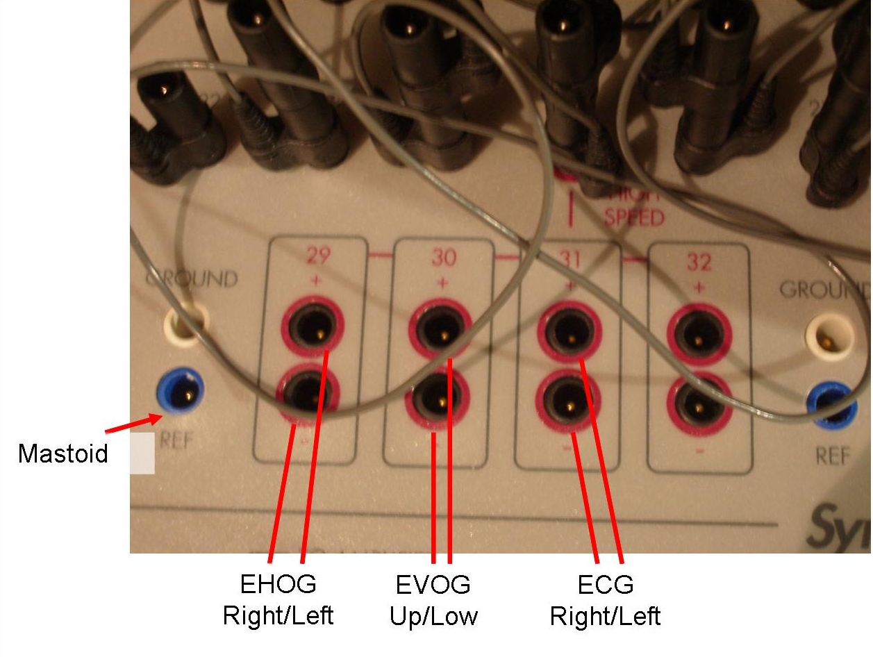 EEG Headbox: Positions Used for EOG/ECG Measurements.