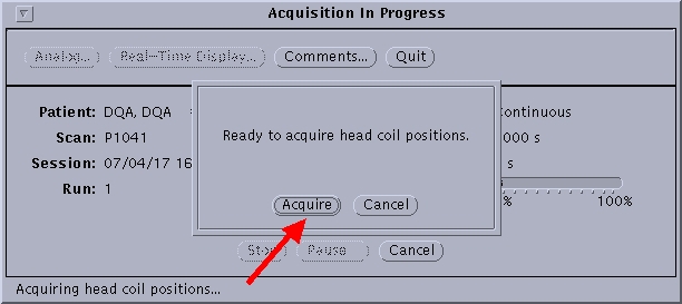 Acquire Head Coil Positions